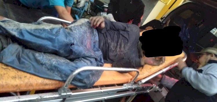 Salah seorang korban erupsi Gunung Semeru yang mengalami luka bakar. (Istimewa/rmolsumsel.id)