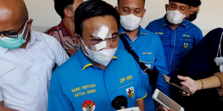 Kondisi terkini Ketua Umum DPP Komite Nasional Pemuda Indonesia (KNPI) Haris Pertama usai dikeroyok orang tak dikenal/Ist