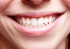Catat, Ini Cara Mencegah dan Membersihkan Karang Gigi