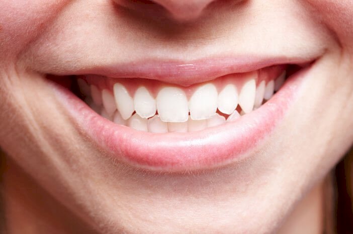 Gigi sehat tanpa karang gigi. (Net/rmolsumsel.id)