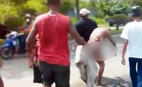 Kakek Suali mengalami luka bakar serius usai membantu memadamkan api yang membakar satu unit sepeda motor di Jalan Pangeran Ratu, Senin siang (4/4). (Ist/rmolsumsel.id)