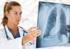Ini 3 Penyebab Infeksi Paru-paru serta Faktor Risikonya yang Wajib Diketahui