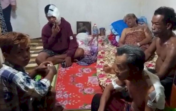 Satu keluarga menjadi korban penyiraman air keras di Palembang. (Ist). 