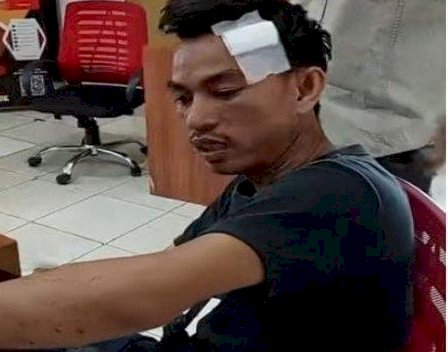 Supriadi (29) warga Jalan Perindustrian Kecamatan Sukarami yang berprofesi sebagai Dj di salah satu kafe di Palembang disekap dipukuli di Kampung Baru Palembang, Selasa (3/1/).(ist/rmolsumsel.id)