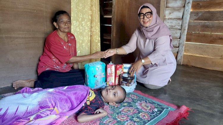 Pihak Puskesmas memberikan bantuan berupa roti, susu dan popok untuk Kaka, bocah penderita cairan di otak/ist.