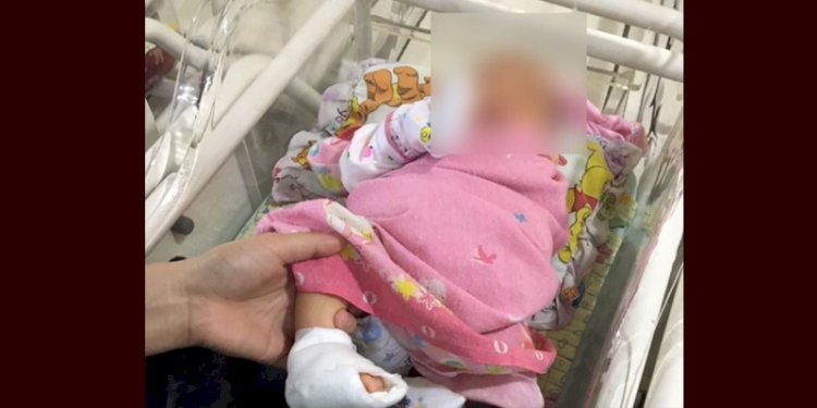  Bayi yang diduga korban malapraktik di Medan/Ist
