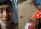 Diduga Korban Tawuran, Remaja di Palembang Tewas Dengan Kondisi Luka Tusuk