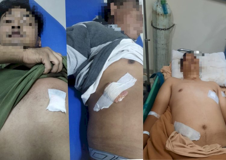 Tiga anggota Reskrim Muratara yang mengalami luka tusuk. (dok. Polisi)