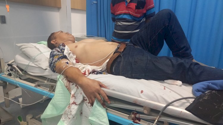 Korban Deddi debt collector di Palembang mengalami luka tusuk yang dilakukan oknum anggota polisi/ist