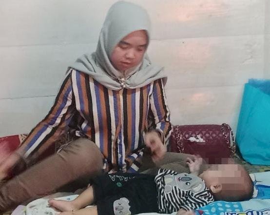 Muhammad Elgio Pratama bayi berusia 10 bulan yang mengalami penyakit kelamin ganda di Palembang. (Handout)