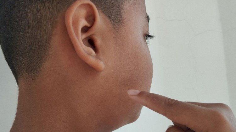  Salah satu anak penderita mumps atau gondongan.(nandoenk/rmolsumsel.id)