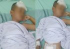 Anak yang Kencing Bercabang Usai Sunatan Massal Jalani Operasi di RSMH Palembang
